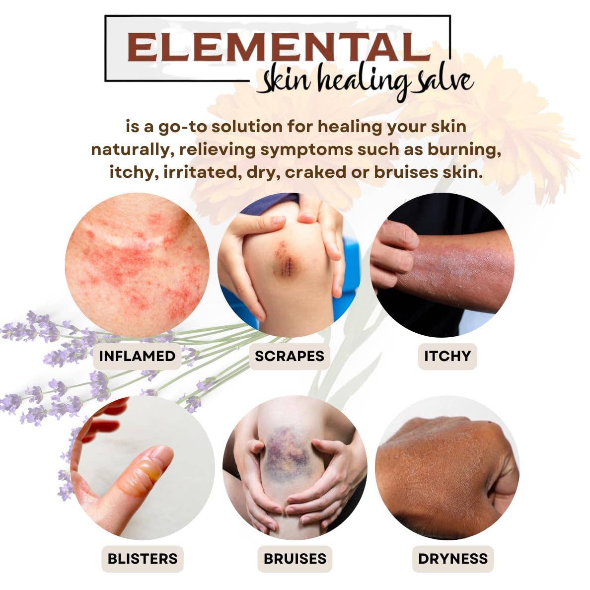 Calendula Salve | Natural Relief for Dry, Irritated Skin