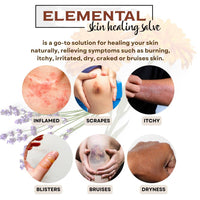 Calendula Salve | Natural Relief for Dry, Irritated Skin